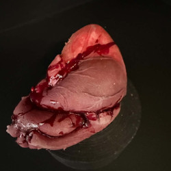 Human Heart
