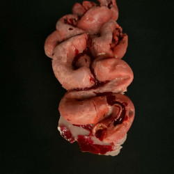 Human Intestines