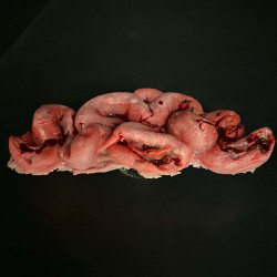 Human Intestines