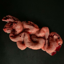 Human Intestines