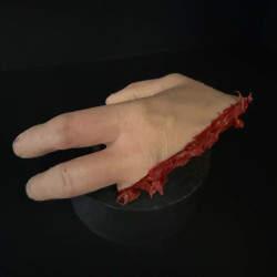 Lacerated Hand