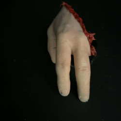 Lacerated Hand